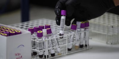 Estudios revelan la posibilidad de crear células madre para tratar la leucemia